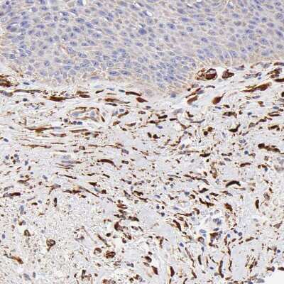 Immunohistochemistry-Paraffin: SPARC Antibody [NBP1-80971]