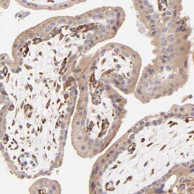 Immunohistochemistry-Paraffin: SPARC Antibody [NBP1-80972]