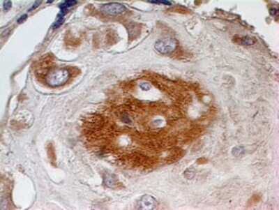 Immunohistochemistry-Paraffin: SPARC Antibody [NBP2-27358]