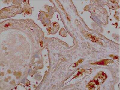 Immunohistochemistry-Paraffin: SPARC Antibody (MM0557-8N38) - Azide and BSA Free [NBP2-11913]