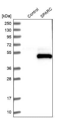 Western Blot: SPARC Antibody [NBP1-80971]