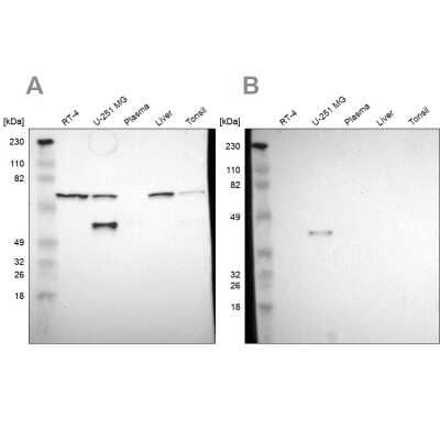 Western Blot: SPARC Antibody [NBP1-80971]