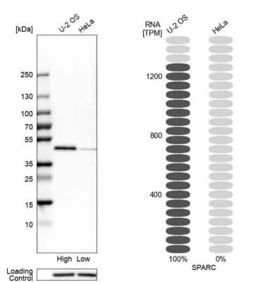 Western Blot: SPARC Antibody [NBP1-80972]