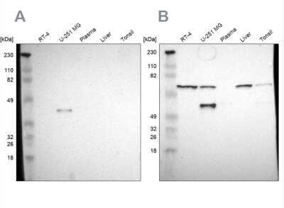 Western Blot: SPARC Antibody [NBP1-80972]
