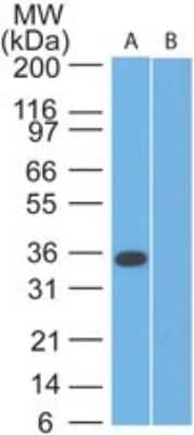 Western Blot: SPARC Antibody [NBP2-27358]