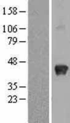 Western Blot: SPARC Overexpression Lysate [NBL1-16372]