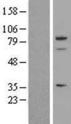 Western Blot: SPARC-like 1/SPARCL1 Overexpression Lysate [NBL1-16373]