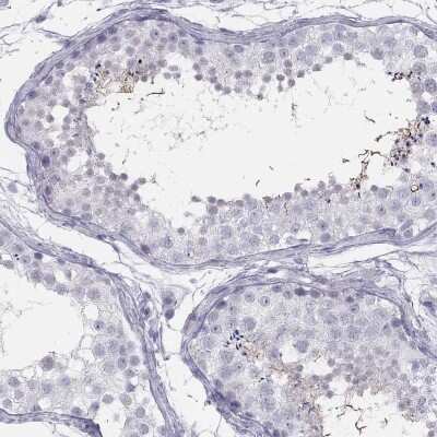Immunohistochemistry-Paraffin: SPATA12 Antibody [NBP3-17143]
