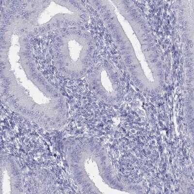 Immunohistochemistry-Paraffin: SPATA12 Antibody [NBP3-17143]
