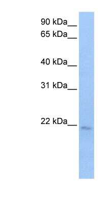 Western Blot: SPATA12 Antibody [NBP1-79430]