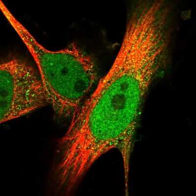 Immunocytochemistry/ Immunofluorescence: SPATA13 Antibody [NBP1-90849]