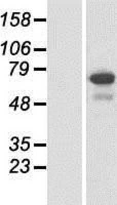 Western Blot: SPATA13 Overexpression Lysate [NBP2-05293]