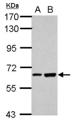 Western Blot: SPATA16 Antibody [NBP2-20466]