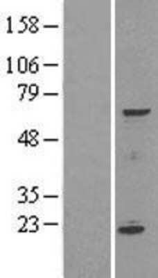 Western Blot: SPATA16 Overexpression Lysate [NBL1-16375]