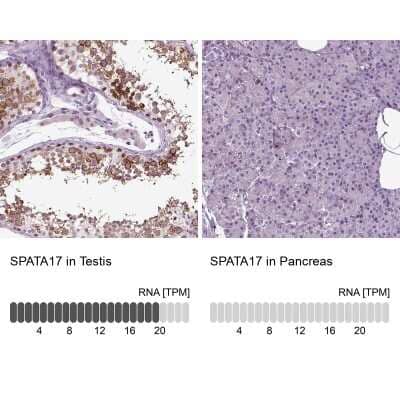 Immunohistochemistry-Paraffin: SPATA17 Antibody [NBP1-83097]