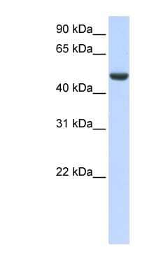 Western Blot: SPATA17 Antibody [NBP1-55371]