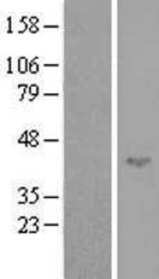 Western Blot: SPATA17 Overexpression Lysate [NBL1-16376]