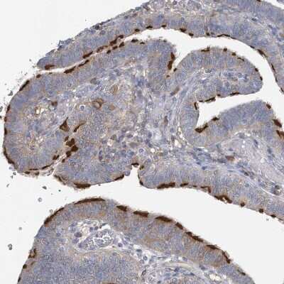 Immunohistochemistry-Paraffin: SPATA18 Antibody [NBP1-81984]