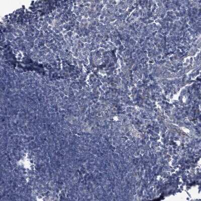 Immunohistochemistry-Paraffin: SPATA18 Antibody [NBP1-81984]