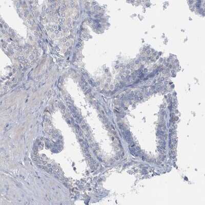 Immunohistochemistry-Paraffin: SPATA18 Antibody [NBP1-81984]