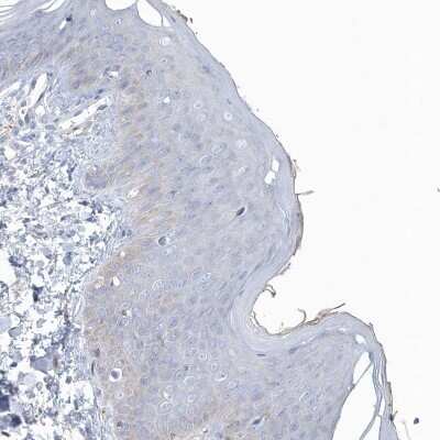 Immunohistochemistry-Paraffin: SPATA18 Antibody [NBP1-81984]