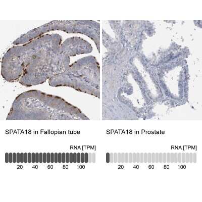 Immunohistochemistry-Paraffin: SPATA18 Antibody [NBP1-81984]