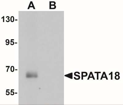 Western Blot: SPATA18 AntibodyBSA Free [NBP2-41148]