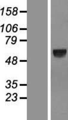 Western Blot: SPATA18 Overexpression Lysate [NBL1-16377]