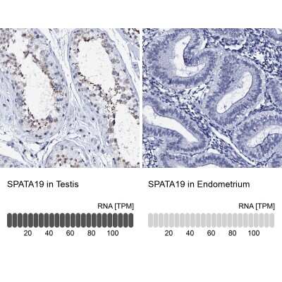 Immunohistochemistry-Paraffin: SPATA19 Antibody [NBP2-31979]