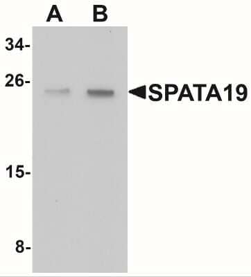 Western Blot: SPATA19 AntibodyBSA Free [NBP2-41149]