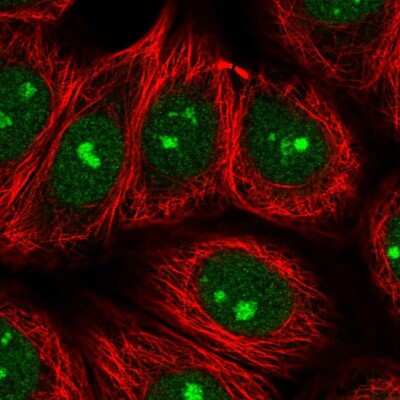 Immunocytochemistry/ Immunofluorescence: SPATA2 Antibody [NBP2-56803]