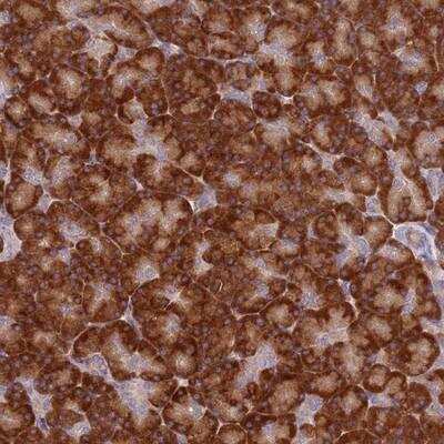 Immunohistochemistry-Paraffin: SPATA2 Antibody [NBP2-13369]