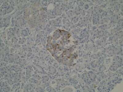 Immunohistochemistry: SPATA2 Antibody (Z1P1F10*F12) - BSA Free [NBP2-50304]