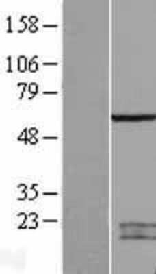 Western Blot: SPATA2 Overexpression Lysate [NBP2-09581]