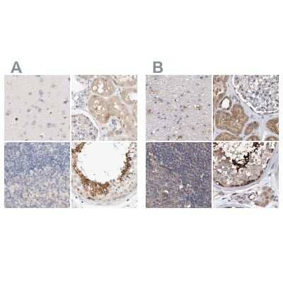 Immunohistochemistry-Paraffin: SPATA20 Antibody [NBP1-82146]