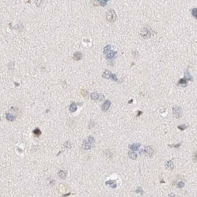 Immunohistochemistry-Paraffin: SPATA20 Antibody [NBP1-82146]