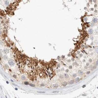 Immunohistochemistry-Paraffin: SPATA20 Antibody [NBP1-82146]