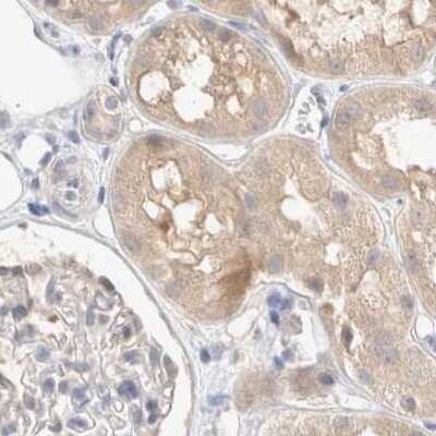 Immunohistochemistry-Paraffin: SPATA20 Antibody [NBP1-82146]