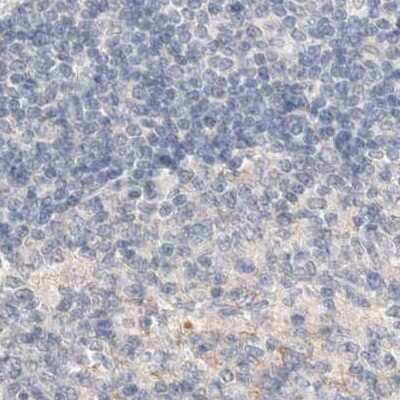 Immunohistochemistry-Paraffin: SPATA20 Antibody [NBP1-82146]