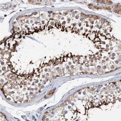 Immunohistochemistry-Paraffin: SPATA20 Antibody [NBP1-82148]