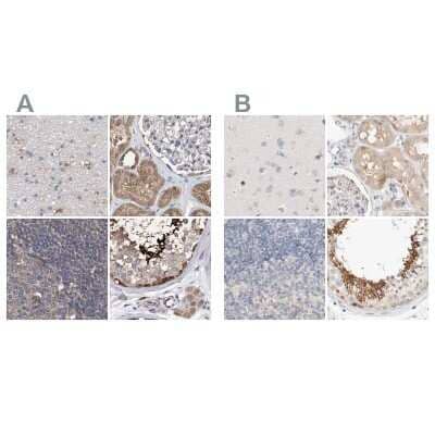 Immunohistochemistry-Paraffin: SPATA20 Antibody [NBP1-82148]