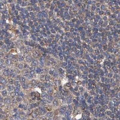 Immunohistochemistry-Paraffin: SPATA20 Antibody [NBP1-82148]