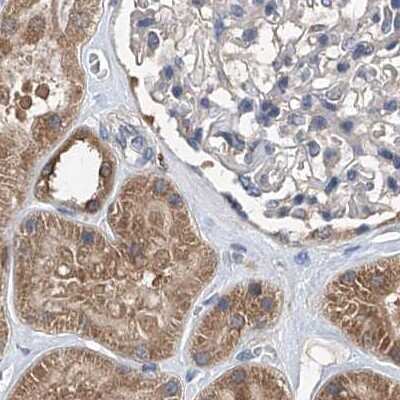 Immunohistochemistry-Paraffin: SPATA20 Antibody [NBP1-82148]