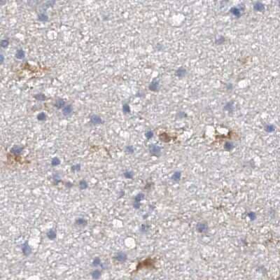 Immunohistochemistry-Paraffin: SPATA20 Antibody [NBP1-82148]