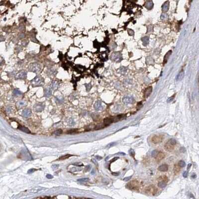 Immunohistochemistry-Paraffin: SPATA20 Antibody [NBP1-82148]