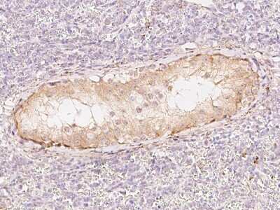 Immunohistochemistry-Paraffin: SPATA20 Antibody [NBP2-97798]