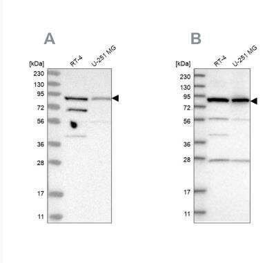 Western Blot: SPATA20 Antibody [NBP1-82146]