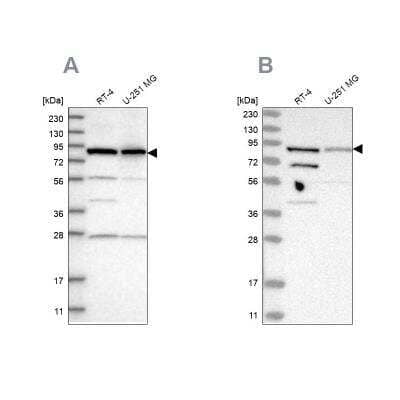 Western Blot: SPATA20 Antibody [NBP1-82147]