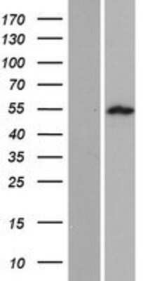 Western Blot: SPATA21 Overexpression Lysate [NBP2-04681]