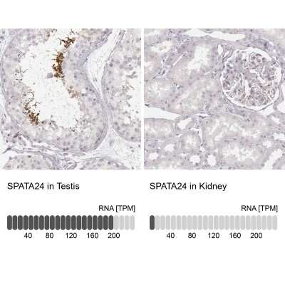 Immunohistochemistry-Paraffin: SPATA24 Antibody [NBP1-92429]